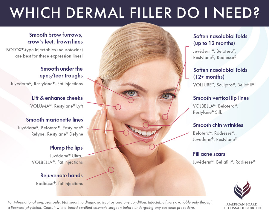 graphic detailing with dermal fillers are best for which areas of the face